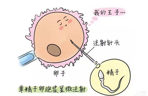 除了不孕不育患者，这3类人也需要泰国试管