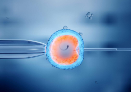 国外的费用是多少