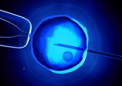 俄罗斯icrm医院试管婴儿的价格