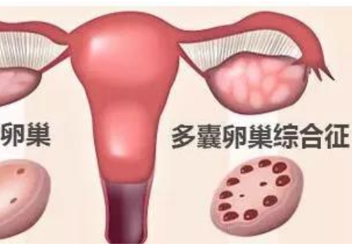 试管婴儿成功率泰国？​