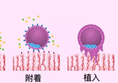 俄罗斯试管婴儿医院靠谱吗？